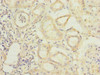 Immunohistochemistry of paraffin-embedded human kidney tissue using CSB-PA04569A0Rb at dilution of 1:100