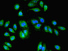 Immunofluorescent analysis of PC-3 cells using CSB-PA04569A0Rb at dilution of 1:100 and Alexa Fluor 488-congugated AffiniPure Goat Anti-Rabbit IgG (H+L)