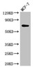 Western Blot<br />
 Positive WB detected in: MCF-7 whole cell lysate<br />
 All lanes: KARS antibody at 2.5µg/ml<br />
 Secondary<br />
 Goat polyclonal to rabbit IgG at 1/50000 dilution<br />
 Predicted band size: 69, 72 kDa<br />
 Observed band size: 69 kDa<br />