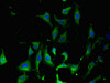 Immunofluorescent analysis of Hela cells using CSB-PA04689A0Rb at dilution of 1:100 and Alexa Fluor 488-congugated AffiniPure Goat Anti-Rabbit IgG (H+L)