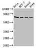 Western Blot<br />
 Positive WB detected in: Hela whole cell lysate, MCF-7 whole cell lysate, HepG2 whole cell lysate, A549 whole cell lysate<br />
 All lanes: HSPA5 antibody at 4µg/ml<br />
 Secondary<br />
 Goat polyclonal to rabbit IgG at 1/50000 dilution<br />
 Predicted band size: 73 kDa<br />
 Observed band size: 73 kDa<br />