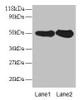 Western blot<br />
 All lanes: RPN1 antibody at 2µg/ml<br />
 Lane 1: EC109 whole cell lysate<br />
 Lane 2: 293T whole cell lysate<br />
 Secondary<br />
 Goat polyclonal to rabbit IgG at 1/15000 dilution<br />
 Predicted band size: 50 kDa<br />
 Observed band size: 50 kDa<br />