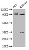 Western Blot<br />
 Positive WB detected in: PC-3 whole cell lysate, Rat kidney tissue<br />
 All lanes: CDK11A antibody at 4µg/ml<br />
 Secondary<br />
 Goat polyclonal to rabbit IgG at 1/50000 dilution<br />
 Predicted band size: 92, 91, 46, 19, 63, 50 kDa<br />
 Observed band size: 92 kDa<br />