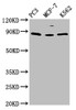 Western Blot<br />
 Positive WB detected in: PC-3 whole cell lysate, MCF-7 whole cell lysate, K562 whole cell lysate<br />
 All lanes: TRIM28 antibody at 1.5µg/ml<br />
 Secondary<br />
 Goat polyclonal to rabbit IgG at 1/50000 dilution<br />
 Predicted band size: 89, 80 kDa<br />
 Observed band size: 89 kDa<br />