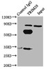 Immunoprecipitating TRIM28 in Hela whole cell lysate<br />
 Lane 1: Rabbit control IgG (1µg) instead of CSB-PA05254A0Rb in Hela whole cell lysate.
 For western blotting, a HRP-conjugated Protein G antibody was used as the secondary antibody (1/2000) <br />
 Lane 2: CSB-PA05254A0Rb (6µg) + Hela whole cell lysate (500µg) <br />
 Lane 3: Hela whole cell lysate (10µg) <br />