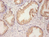 Immunohistochemistry of paraffin-embedded human prostate tissue using CSB-PA05345A0Rb at dilution of 1:100