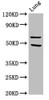 Western Blot<br />
 Positive WB detected in: Rat lung tissue<br />
 All lanes: PAK4 antibody at 3.2µg/ml<br />
 Secondary<br />
 Goat polyclonal to rabbit IgG at 1/50000 dilution<br />
 Predicted band size: 65, 48, 49, 55 kDa<br />
 Observed band size: 65 kDa<br />
