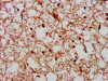 IHC image of CSB-PA05437A0Rb diluted at 1:800 and staining in paraffin-embedded human brain tissue performed on a Leica BondTM system. After dewaxing and hydration, antigen retrieval was mediated by high pressure in a citrate buffer (pH 6.0) . Section was blocked with 10% normal goat serum 30min at RT. Then primary antibody (1% BSA) was incubated at 4°C overnight. The primary is detected by a biotinylated secondary antibody and visualized using an HRP conjugated SP system.