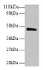 Western blot<br />
 All lanes: PICK1 antibody at 2µg/ml + Mouse brain tissue<br />
 Secondary<br />
 Goat polyclonal to rabbit IgG at 1/10000 dilution<br />
 Predicted band size: 47, 40 kDa<br />
 Observed band size: 47 kDa<br />