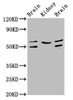 Western Blot<br />
 Positive WB detected in: Rat brain tissue, Rat kidney tissue, Mouse brain tissue<br />
 All lanes: ANGPT2 antibody at 3.2µg/ml<br />
 Secondary<br />
 Goat polyclonal to rabbit IgG at 1/50000 dilution<br />
 Predicted band size: 57, 51 kDa<br />
 Observed band size: 57, 51 kDa<br />