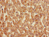 Immunohistochemistry of paraffin-embedded human liver tissue using CSB-PA05759A0Rb at dilution of 1:100