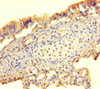 Immunohistochemistry of paraffin-embedded human lung tissue using CSB-PA05799A0Rb at dilution of 1:100