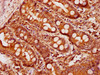 IHC image of CSB-PA05799A0Rb diluted at 1:600 and staining in paraffin-embedded human small intestine tissue performed on a Leica BondTM system. After dewaxing and hydration, antigen retrieval was mediated by high pressure in a citrate buffer (pH 6.0) . Section was blocked with 10% normal goat serum 30min at RT. Then primary antibody (1% BSA) was incubated at 4°C overnight. The primary is detected by a biotinylated secondary antibody and visualized using an HRP conjugated SP system.