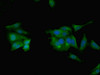 Immunofluorescent analysis of Hela cells using CSB-PA05864A0Rb at dilution of 1:100 and Alexa Fluor 488-congugated AffiniPure Goat Anti-Rabbit IgG (H+L)