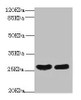 Western blot<br />
 All lanes: CRP antibody at 2µg/ml<br />
 Lane 1: High values of serum at 1: 5<br />
 Lane 2: High values of serum at 1: 10<br />
 Secondary<br />
 Goat polyclonal to rabbit IgG at 1/10000 dilution<br />
 Predicted band size: 26, 11 kDa<br />
 Observed band size: 26 kDa<br />