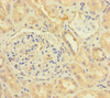 Immunohistochemistry of paraffin-embedded human kidney tissue using CSB-PA06087A0Rb at dilution of 1:100