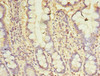 Immunohistochemistry of paraffin-embedded human small intestine tissue using CSB-PA06169A0Rb at dilution of 1:100