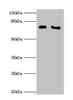 Western blot<br />
 All lanes: POR antibody at 2µg/ml<br />
 Lane 1: K562 whole cell lysate<br />
 Lane 2: A431 whole cell lysate<br />
 Secondary<br />
 Goat polyclonal to rabbit IgG at 1/10000 dilution<br />
 Predicted band size: 77 kDa<br />
 Observed band size: 77 kDa<br />