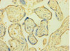 Immunohistochemistry of paraffin-embedded human placenta tissue using CSB-PA06275A0Rb at dilution of 1:100