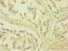 Immunohistochemistry of paraffin-embedded human prostate tissue using CSB-PA06275A0Rb at dilution of 1:100