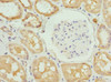 Immunohistochemistry of paraffin-embedded human kidney tissue using CSB-PA06329A0Rb at dilution of 1:100
