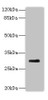 Western blot<br />
 All lanes: PROCR antibody at 2µg/ml + Mouse lung tissue<br />
 Secondary<br />
 Goat polyclonal to rabbit at 1/10000 dilution<br />
 Predicted band size: 27 kDa<br />
 Observed band size: 27 kDa<br />