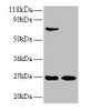 Western blot<br />
 All lanes: IFNG antibody at 2µg/ml<br />
 Lane 1: EC109 whole cell lysate<br />
 Lane 2: 293T whole cell lysate<br />
 Secondary<br />
 Goat polyclonal to rabbit IgG at 1/15000 dilution<br />
 Predicted band size: 20 kDa<br />
 Observed band size: 27 kDa<br />