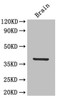 Western Blot<br />
 Positive WB detected in: Mouse brain tissue<br />
 All lanes: IL12B antibody at 4µg/ml<br />
 Secondary<br />
 Goat polyclonal to rabbit IgG at 1/50000 dilution<br />
 Predicted band size: 38 kDa<br />
 Observed band size: 38 kDa<br />