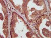 IHC image of CSB-PA06867A0Rb diluted at 1:400 and staining in paraffin-embedded human prostate tissue performed on a Leica BondTM system. After dewaxing and hydration, antigen retrieval was mediated by high pressure in a citrate buffer (pH 6.0) . Section was blocked with 10% normal goat serum 30min at RT. Then primary antibody (1% BSA) was incubated at 4°C overnight. The primary is detected by a biotinylated secondary antibody and visualized using an HRP conjugated SP system.