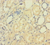 Immunohistochemistry of paraffin-embedded human kidney tissue using CSB-PA06919A0Rb at dilution of 1:100