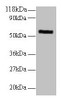 Western blot<br />
 All lanes: MMP1 antibody at 2µg/ml + 293T whole cell lysate<br />
 Secondary<br />
 Goat polyclonal to rabbit IgG at 1/10000 dilution<br />
 Predicted band size: 55 kDa<br />
 Observed band size: 55 kDa<br />