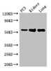 Western Blot<br />
 Positive WB detected in: PC-3 whole cell lysate, Mouse kidney tissue, Mouse lung tissue<br />
 All lanes: MMP13 antibody at 2µg/ml<br />
 Secondary<br />
 Goat polyclonal to rabbit IgG at 1/50000 dilution<br />
 Predicted band size: 54 kDa<br />
 Observed band size: 54 kDa<br />