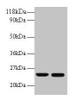 Western blot<br />
 All lanes: RBP4 antibody at 2µg/ml<br />
 Lane 1: Human positive serum at 1: 10<br />
 Lane 2: Human positive serum at 1: 100<br />
 Secondary<br />
 Goat polyclonal to rabbit IgG at 1/50000 dilution<br />
 Predicted band size: 24 kDa<br />
 Observed band size: 24 kDa<br />