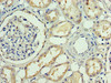 Immunohistochemistry of paraffin-embedded human kidney tissue using CSB-PA07179A0Rb at dilution of 1:100