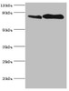 Western blot<br />
 All lanes: Transferrin receptor protein 1 antibody at 2µg/ml<br />
 Lane 1: U251 whole cell lysate<br />
 Lane 2: 293T whole cell lysate<br />
 Secondary<br />
 Goat polyclonal to rabbit IgG at 1/10000 dilution<br />
 Predicted band size: 85 kDa<br />
 Observed band size: 85 kDa<br />