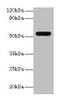 Western blot<br />
 All lanes: MMP3 antibody at 2µg/ml + Mouse liver tissue<br />
 Secondary<br />
 Goat polyclonal to rabbit lgG at 1/15000 dilution<br />
 Predicted band size: 54 kDa<br />
 Observed band size: 54 kDa<br />