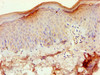 Immunohistochemistry of paraffin-embedded human skin tissue using CSB-PA07449A0Rb at dilution of 1:100