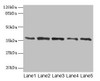 Western blot<br />
 All lanes: PLAUR antibody at 4µg/ml<br />
 Lane 1: Mouse brain tissue<br />
 Lane 2: A2780 whole cell lysate<br />
 Lane 3: MCF-7 whole cell lysate<br />
 Lane 4: Hela whole cell lysate<br />
 Lane 5: Colo320 whole cell lysate<br />
 Secondary<br />
 Goat polyclonal to rabbit IgG at 1/10000 dilution<br />
 Predicted band size: 37, 32, 33 kDa<br />
 Observed band size: 37 kDa<br />