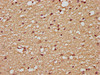 IHC image of CSB-PA07505A0Rb diluted at 1:200 and staining in paraffin-embedded human brain tissue performed on a Leica BondTM system. After dewaxing and hydration, antigen retrieval was mediated by high pressure in a citrate buffer (pH 6.0) . Section was blocked with 10% normal goat serum 30min at RT. Then primary antibody (1% BSA) was incubated at 4°C overnight. The primary is detected by a biotinylated secondary antibody and visualized using an HRP conjugated SP system.