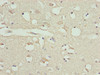 Immunohistochemistry of paraffin-embedded human brain tissue using CSB-PA07864A0Rb at dilution of 1:100