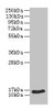 Western blot<br />
 All lanes: NPPB antibody at 2µg/ml + Hela whole cell lysate<br />
 Secondary<br />
 Goat polyclonal to rabbit IgG at 1/10000 dilution<br />
 Predicted band size: 15 kDa<br />
 Observed band size: 15 kDa<br />