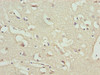 Immunohistochemistry of paraffin-embedded human brain tissue using CSB-PA07926A0Rb at dilution of 1:100