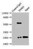 Immunoprecipitating TNNI3 in Rat heart tissue<br />
 Lane 1: Rabbit control IgG instead of CSB-PA07939A0Rb in Rat heart tissue.
 For western blotting, a HRP-conjugated Protein G antibody was used as the secondary antibody (1/5000) <br />
 Lane 2: CSB-PA07939A0Rb (8µg) + Rat heart tissue (500µg) <br />
 Lane 3: Rat heart tissue (20µg) <br />