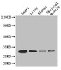 Western Blot<br />
 Positive WB detected in: Mouse heart tissue, Mouse liver tissue, Mouse kidney tissue, Mouse skeletal muscle tissue<br />
 All lanes: ADIPOQ antibody at 4µg/ml<br />
 Secondary<br />
 Goat polyclonal to rabbit IgG at 1/50000 dilution<br />
 Predicted band size: 27 kDa<br />
 Observed band size: 27 kDa<br />