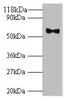 Western blot<br />
 All lanes: Major capsid protein L1 antibody at 2µg/ml + 293T whole cell lysate<br />
 Secondary<br />
 Goat polyclonal to rabbit IgG at 1/10000 dilution<br />
 Predicted band size: 62 kDa<br />
 Observed band size: 62 kDa<br />
