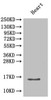 Western Blot<br />
 Positive WB detected in: Mouse heart tissue<br />
 All lanes: Cxcl5 antibody at 2µg/ml<br />
 Secondary<br />
 Goat polyclonal to rabbit IgG at 1/50000 dilution<br />
 Predicted band size: 15 kDa<br />
 Observed band size: 15 kDa<br />