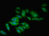 Immunofluorescent analysis of Hela cells using CSB-PA09419A0Rb at dilution of 1:100 and Alexa Fluor 488-congugated AffiniPure Goat Anti-Rabbit IgG (H+L)