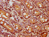 IHC image of CSB-PA09419A0Rb diluted at 1:750 and staining in paraffin-embedded human small intestine tissue performed on a Leica BondTM system. After dewaxing and hydration, antigen retrieval was mediated by high pressure in a citrate buffer (pH 6.0) . Section was blocked with 10% normal goat serum 30min at RT. Then primary antibody (1% BSA) was incubated at 4°C overnight. The primary is detected by a biotinylated secondary antibody and visualized using an HRP conjugated SP system.