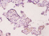 Immunohistochemistry of paraffin-embedded human placenta tissue using CSB-PA09667A0Rb at dilution of 1:20