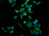 Immunofluorescence staining of Hela cells with CSB-PA09667A0Rb at 1:166, counter-stained with DAPI. The cells were fixed in 4% formaldehyde, permeabilized using 0.2% Triton X-100 and blocked in 10% normal Goat Serum. The cells were then incubated with the antibody overnight at 4°C. The secondary antibody was Alexa Fluor 488-congugated AffiniPure Goat Anti-Rabbit IgG (H+L) .